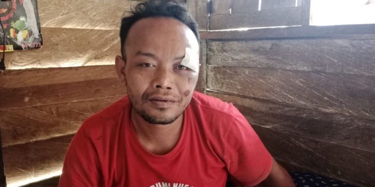 Insiden Penganiayaan Warga Jonggon di Depan Mako Brimob Kukar, Polisi Janji Usut Tuntas